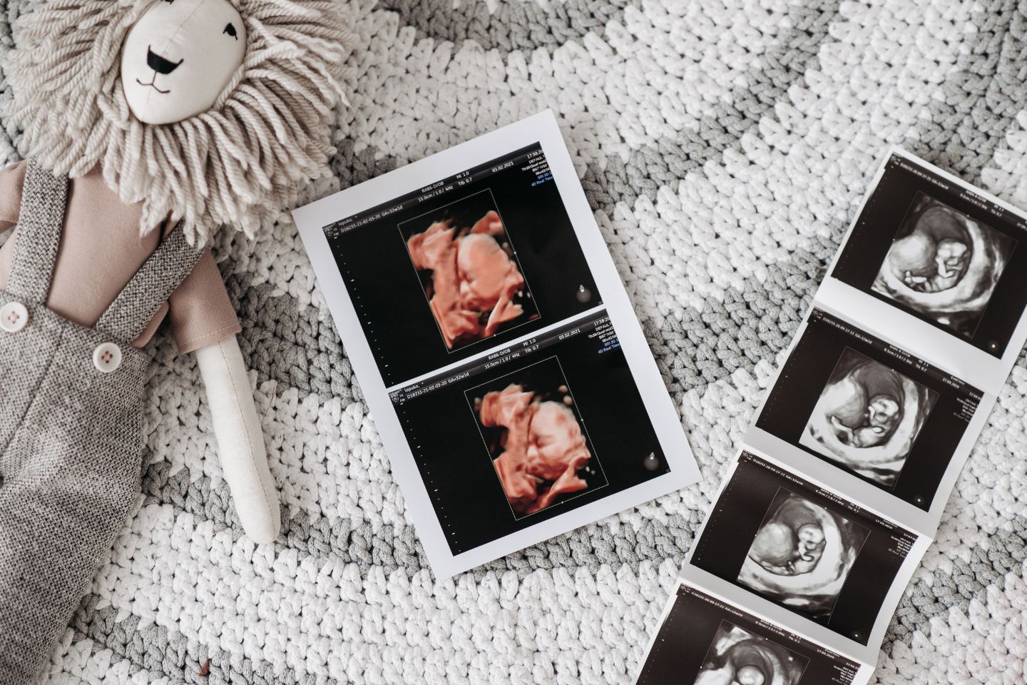Ultraschall Schwangerschaft
