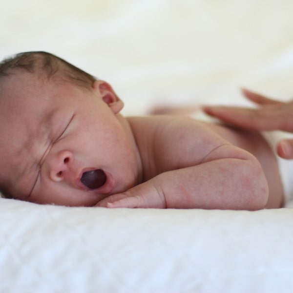 Streicheln hat direkten Einfluss auf das Schmerzempfinden